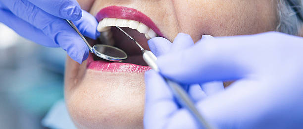 Best Emergency Root Canal Treatment in Mineral Point, WI